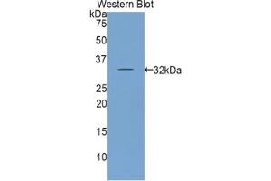 Detection of Recombinant ITIH1, Mouse using Polyclonal Antibody to Inter Alpha-Globulin Inhibitor H1 (ITIH1) (ITIH1 抗体  (AA 413-660))