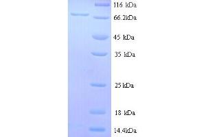 SDS-PAGE (SDS) image for Estrogen Receptor 1 (ESR1) (AA 9-591), (partial) protein (His tag) (ABIN5713438) (Estrogen Receptor alpha Protein (AA 9-591, partial) (His tag))
