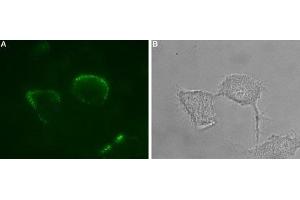 Expression of P2X1 receptor in rat PC12 cells - Cell surface detection of P2X1 receptor in intact living PC12 cells. (P2RX1 抗体  (Extracellular) (Atto 488))