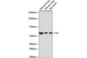 Western blot analysis of extracts of various cell lines, using Src antibody (ABIN7269727) at 1:1000 dilution.