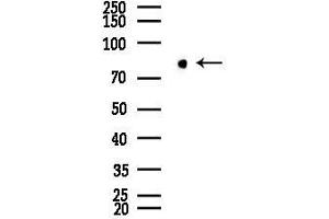 Western blot analysis of lysates from COLO205 cells, using AOC3 Antibody at 1/1000 dilution.