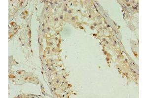 Immunohistochemistry of paraffin-embedded human testis tissue using ABIN7143208 at dilution of 1:100 (ACBD4 抗体  (AA 1-305))