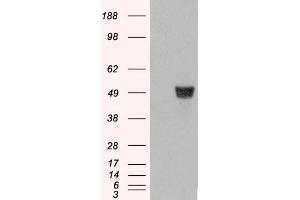 Western Blotting (WB) image for anti-Coronin, Actin Binding Protein, 1A (CORO1A) (C-Term) antibody (ABIN185063)