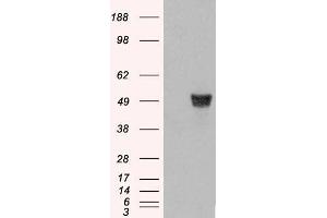 HEK293 overexpressing CORO1A (RC210753) and probed with Antibody (mock transfection in first lane). (Coronin 1a 抗体  (C-Term))