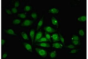 Immunofluorescent analysis of A549 cells using ABIN7176259 at dilution of 1:100 and Alexa Fluor 488-congugated AffiniPure Goat Anti-Rabbit IgG(H+L) (ZNF366 抗体  (AA 455-650))