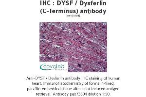 Image no. 1 for anti-Dysferlin (DYSF) (C-Term) antibody (ABIN2852394) (Dysferlin 抗体  (C-Term))
