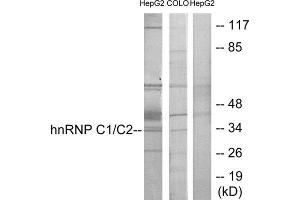 Western Blotting (WB) image for anti-Heterogeneous Nuclear Ribonucleoprotein C (C1/C2) (HNRNPC) (C-Term) antibody (ABIN1849120) (HNRNPC 抗体  (C-Term))