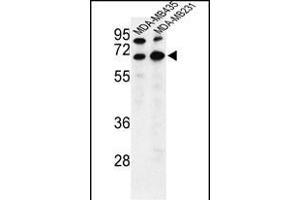 Western blot analysis of BEST2 Antibody (C-term) (ABIN653193 and ABIN2842742) in MDA-M,MDA-M cell line lysates (35 μg/lane). (Bestrophin 2 抗体  (C-Term))