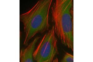 Immunofluorescent analysis of 4 % paraformaldehyde-fixed, 0. (PKN1 抗体  (AA 836-870))