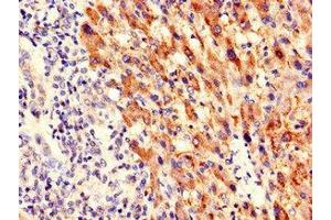 Immunohistochemistry (IHC) image for anti-Pim-3 Oncogene (PIM3) (AA 278-326) antibody (ABIN7169149)