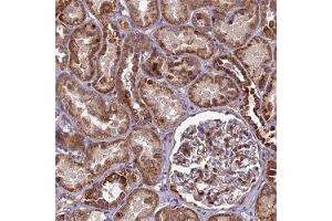 Immunohistochemical staining (Formalin-fixed paraffin-embedded sections) of human kidney shows strong cytoplasmic positivity in renal tubules. (RSPRY1 抗体)