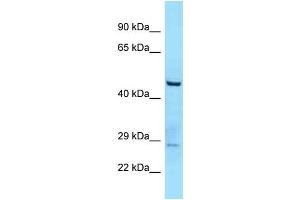 WB Suggested Anti-TTLL3 Antibody Titration: 1. (TTLL3 抗体  (C-Term))