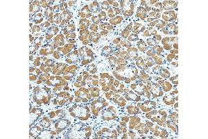 anti-Protein Kinase C, epsilon (PRKCE) (AA 53-236) antibody