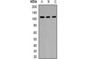 Western blot analysis of FNBP3 expression in HeLa (A), mouse brain (B), rat brain (C) whole cell lysates.