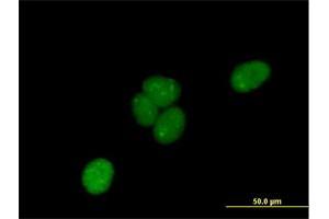 Immunofluorescence of purified MaxPab antibody to C1orf103 on HeLa cell. (C1orf103 抗体  (AA 1-436))