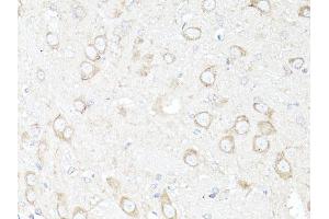 Immunohistochemistry of paraffin-embedded rat brain using MAP1LC3B antibody (ABIN6291775) at dilution of 1:100 (40x lens). (LC3B 抗体)