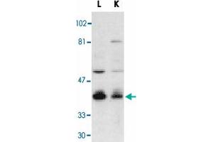 Western blot analysis of Dffb in mouse lung (L) and kidney (K) tissue lysates with Dffb polyclonal antibody  at 1 : 500 dilution. (DFFB 抗体  (AA 314-329))