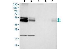 Western blot analysis of Lane 1: RT-4, Lane 2: U-251 MG, Lane 3: Human Plasma, Lane 4: Liver, Lane 5: Tonsil with BNIP2 polyclonal antibody . (BNIP2 抗体)