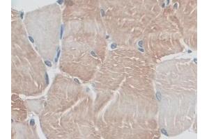 Detection of MYO1D in Rat Skeletal muscle Tissue using Polyclonal Antibody to Myosin ID (MYO1D) (Myosin ID 抗体  (AA 512-788))