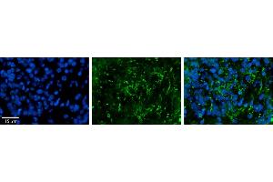 Rabbit Anti-ZDHHC17 Antibody     Formalin Fixed Paraffin Embedded Tissue: Human Pineal Tissue  Observed Staining: Cytoplasmic in vesicles and processes of pinealocytes  Primary Antibody Concentration: 1:100  Secondary Antibody: Donkey anti-Rabbit-Cy3  Secondary Antibody Concentration: 1:200  Magnification: 20X  Exposure Time: 0. (ZDHHC17 抗体  (Middle Region))
