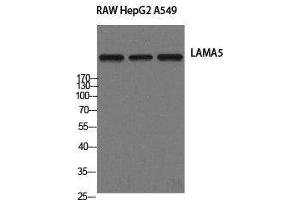 Western Blot analysis of RAW264. (Laminin alpha 5 抗体)