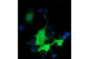 Anti-BEST3 mouse monoclonal antibody (ABIN2452806) immunofluorescent staining of COS7 cells transiently transfected by pCMV6-ENTRY BEST3 (RC218436). (Bestrophin 3 抗体)