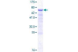 DLK2 Protein (AA 1-383) (GST tag)