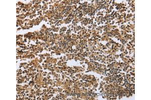 Immunohistochemistry of Human tonsil using ECE1 Polyclonal Antibody at dilution of 1:60 (ECE1 抗体)