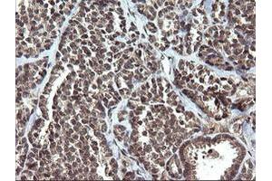 Image no. 5 for anti-V-Ets Erythroblastosis Virus E26 Oncogene Homolog 2 (ETS2) (AA 90-349) antibody (ABIN1491703) (ETS2 抗体  (AA 90-349))