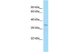 WB Suggested Anti-Ubb Antibody Titration: 1. (Ubiquitin B 抗体  (N-Term))