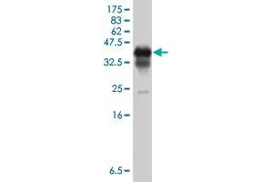 Western Blot detection against Immunogen (37 KDa) . (PCBP1 抗体  (AA 181-280))