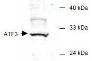 Image no. 1 for anti-Activating Transcription Factor 3 (ATF3) (AA 113-130) antibody (ABIN401262) (ATF3 抗体  (AA 113-130))
