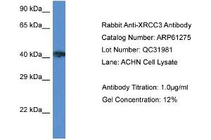 Western Blotting (WB) image for anti-X-Ray Repair Complementing Defective Repair in Chinese Hamster Cells 3 (XRCC3) (Middle Region) antibody (ABIN2774310)