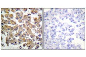Immunohistochemistry (IHC) image for anti-Transforming Growth Factor, beta 1 (TGFB1) (C-Term) antibody (ABIN1848794) (TGFB1 抗体  (C-Term))