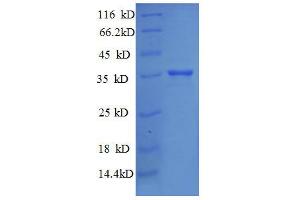 30S Ribosomal Protein S18 (AA 2-75), (full length) protein (GST tag) (30S Ribosomal Protein S18 (RpsR) (AA 2-75), (full length) protein (GST tag))