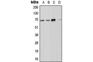 Western blot analysis of NOX4 expression in JAR (A), Jurkat (B), SP2/0 (C), PC12 (D) whole cell lysates. (NADPH Oxidase 4 抗体  (N-Term))