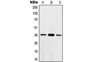 Western blot analysis of HOXB2 expression in Jurkat (A), HepG2 (B), A549 (C) whole cell lysates. (HOXB2 抗体  (Center))
