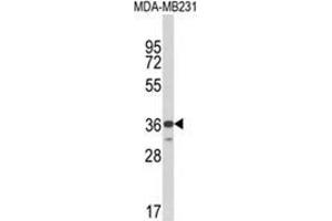 Western blot analysis of MICA Antibody (Center) in MDA-MB231 cell line lysates (35ug/lane). (MICA 抗体  (Middle Region))