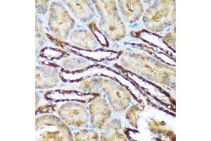 Immunohistochemistry (IHC) image for anti-Versican (Vcan) antibody (ABIN7271309)
