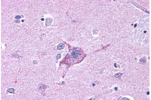 Anti-NPY5R antibody  ABIN1049125 IHC staining of human brain, neurons and glia. (NPY5R 抗体  (Cytoplasmic Domain))