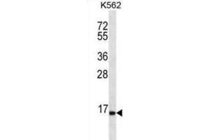 Western Blotting (WB) image for anti-Serine Peptidase Inhibitor, Kazal Type 8 (SPINK8) antibody (ABIN2996842)