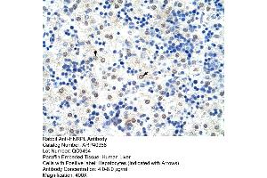 Rabbit Anti-HNRPL Antibody  Paraffin Embedded Tissue: Human Liver Cellular Data: Hepatocytes Antibody Concentration: 4. (HNRNPL 抗体  (N-Term))