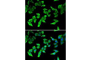Immunofluorescence analysis of U2OS cell using MLH1 antibody. (MLH1 抗体)