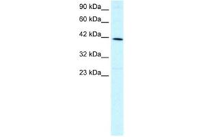 WB Suggested Anti-FOXF2 Antibody Titration: 1. (FOXF2 抗体  (N-Term))
