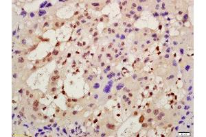 Formalin-fixed and paraffin embedded mouse placenta labeled with Rabbit Anti-AMIGO2 Polyclonal Antibody, Unconjugated (ABIN1386548) at 1:200 followed by conjugation to the secondary antibody and DAB staining (AMIGO2 抗体  (AA 21-120))