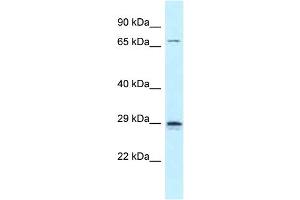 WB Suggested Anti-Neurog2 Antibody Titration: 1. (Neurogenin 2 抗体  (C-Term))