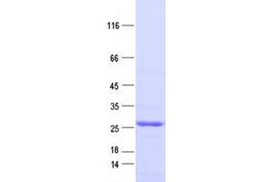 Western Blotting (WB) image for Insulin-Like Growth Factor 1 Receptor (IGF1R) protein (DYKDDDDK Tag) (ABIN2713511)