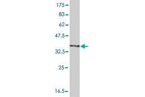 Western Blot detection against Immunogen (37. (HBA1 抗体  (AA 33-142))