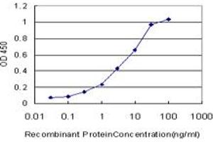 Detection limit for recombinant GST tagged PSPH is approximately 0. (PSPH 抗体  (AA 1-100))