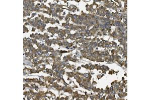 IHC analysis of ALDH1L1 using anti-ALDH1L1 antibody (ABIN7601093). (ALDH1L1 抗体  (AA 282-424))